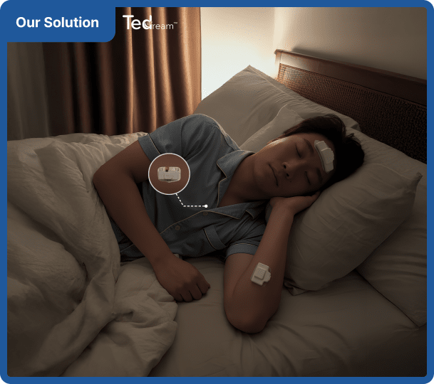 Tedream forehead and forearm patches worn during sleep