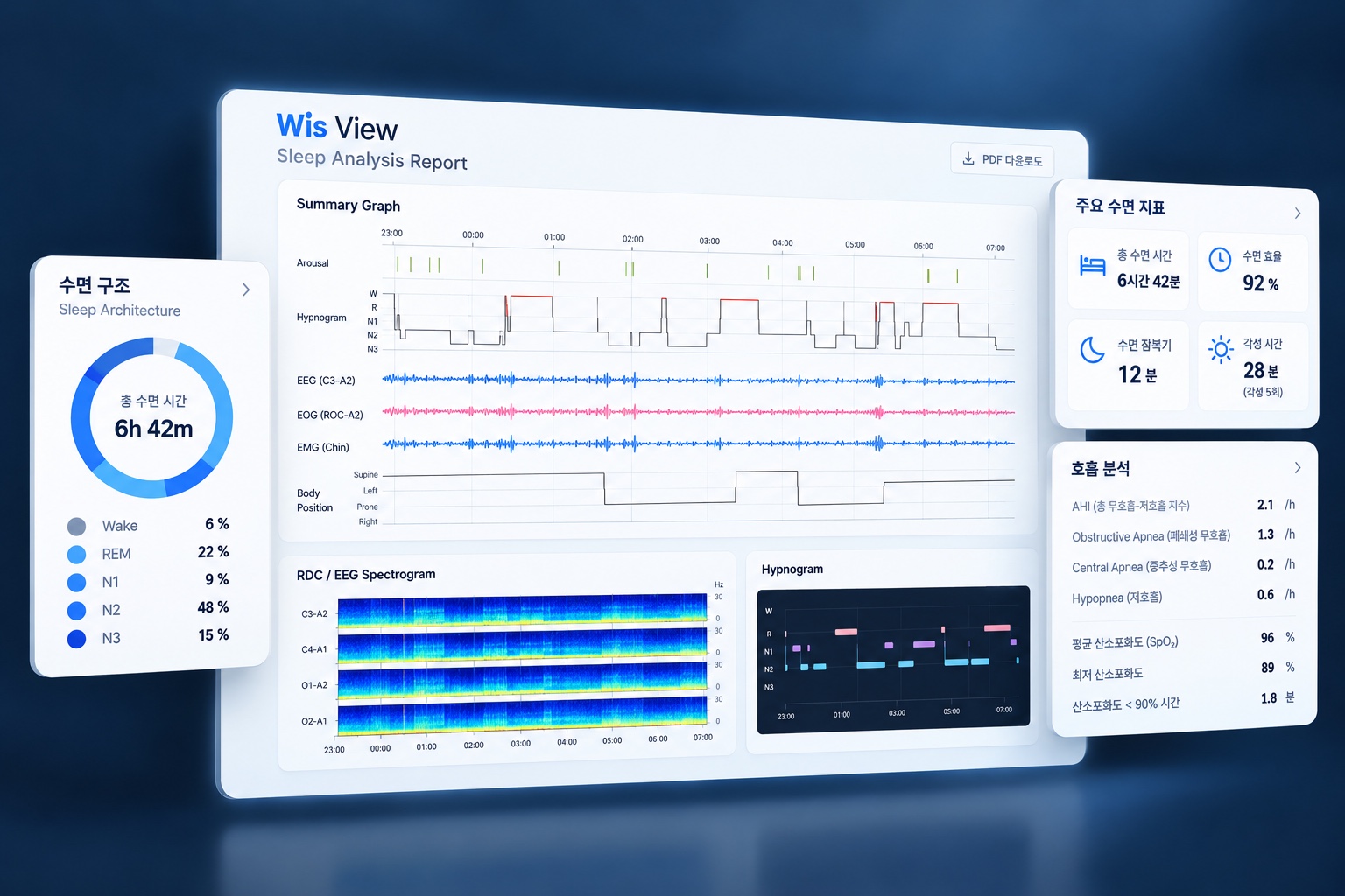 Wis View sleep report showing hypnogram, biosignals, and clinical summary